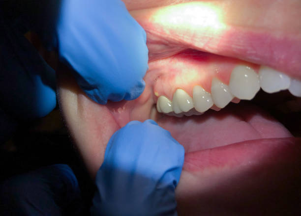Best Weekend Emergency Dentist in Wharton, TX