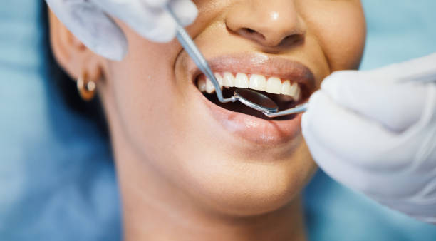 Best Emergency Root Canal Treatment in Wharton, TX